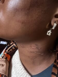 FCT Police Crush “One Chance” Robbery Gang — Six Arrested, One Killed